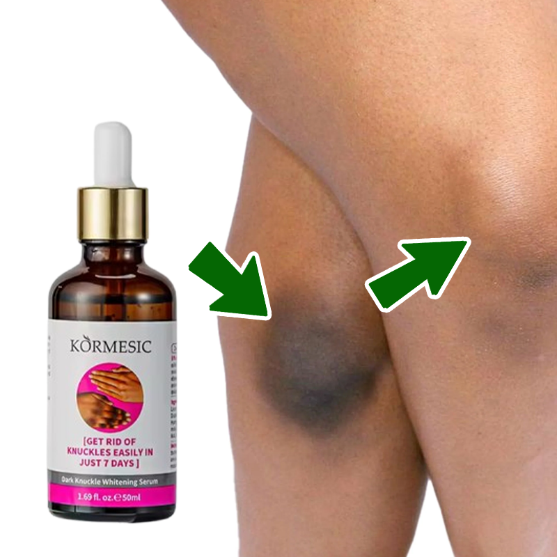 Knuckle Whitening Serum