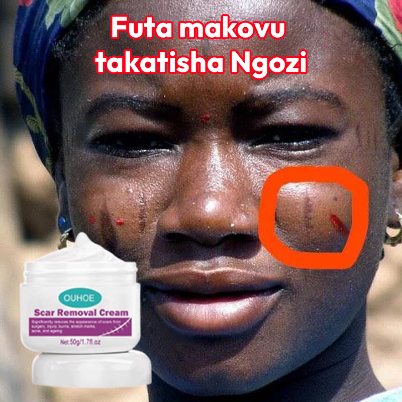 Scar Removal Cream