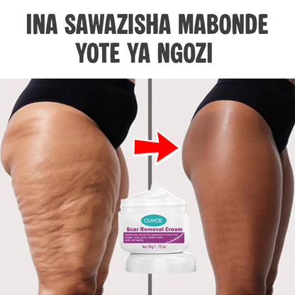 Scar Removal Cream