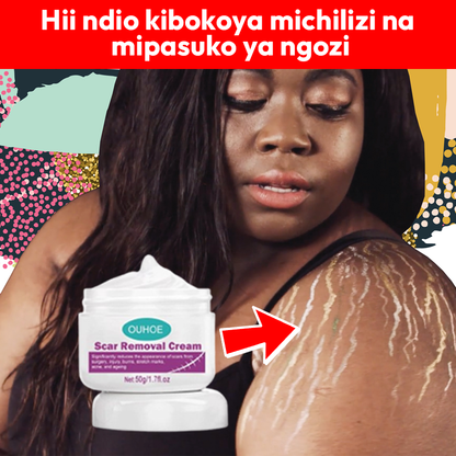 Scar Removal Cream