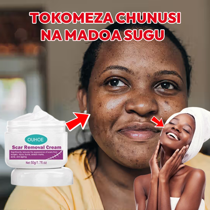 Scar Removal Cream