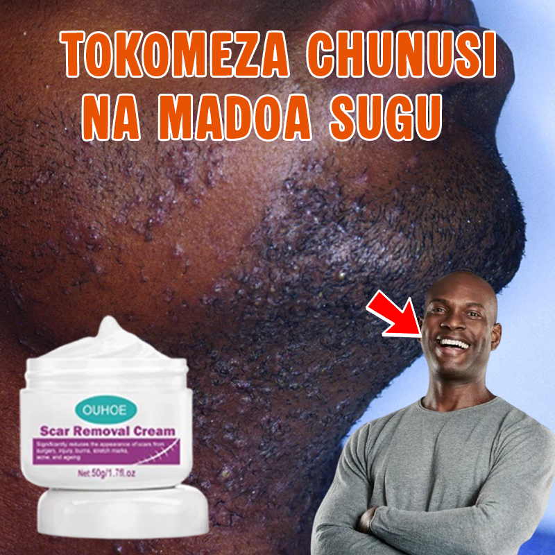 Scar Removal Cream