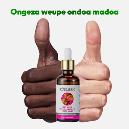 Knuckle Whitening Serum